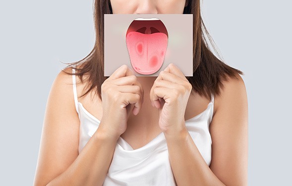 Patient holding an illustration of oral cancer on a tongue