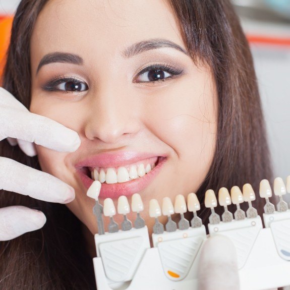 Woman's smile compared to veneers color chart by cosmetic dentist