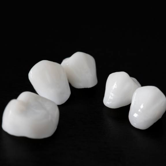 Metal free dental restorations prior to placement