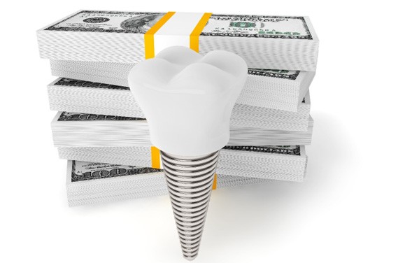 Dental implant in front of a pile of money