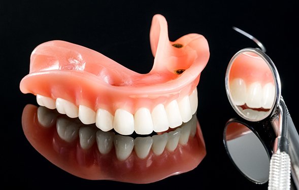 Detailed look at an implant denture
