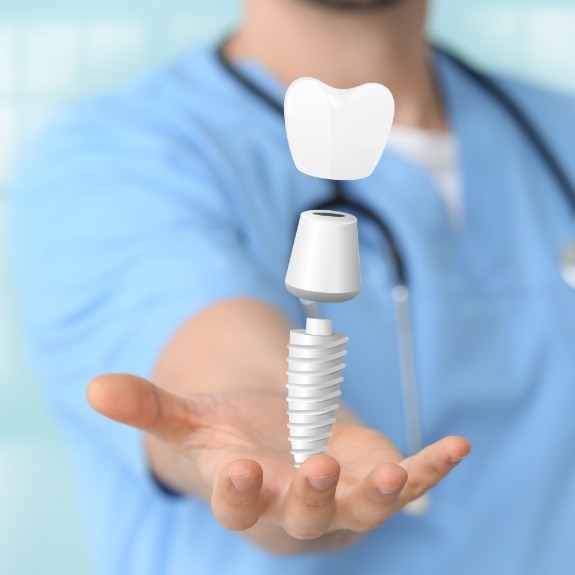 Dentist holding an animated dental implant