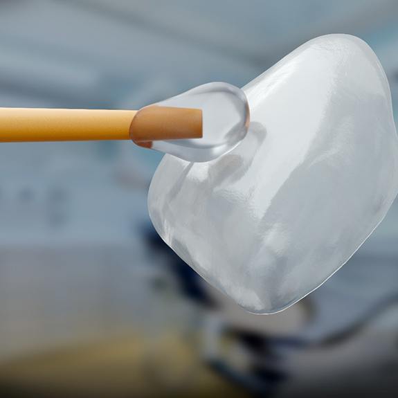 a dental veneer being held up with a small instrument