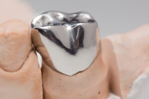 Metal dental crown.